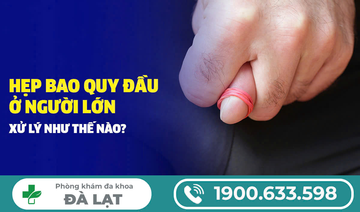 HẸP BAO QUY ĐẦU XỬ LÝ THẾ NÀO?